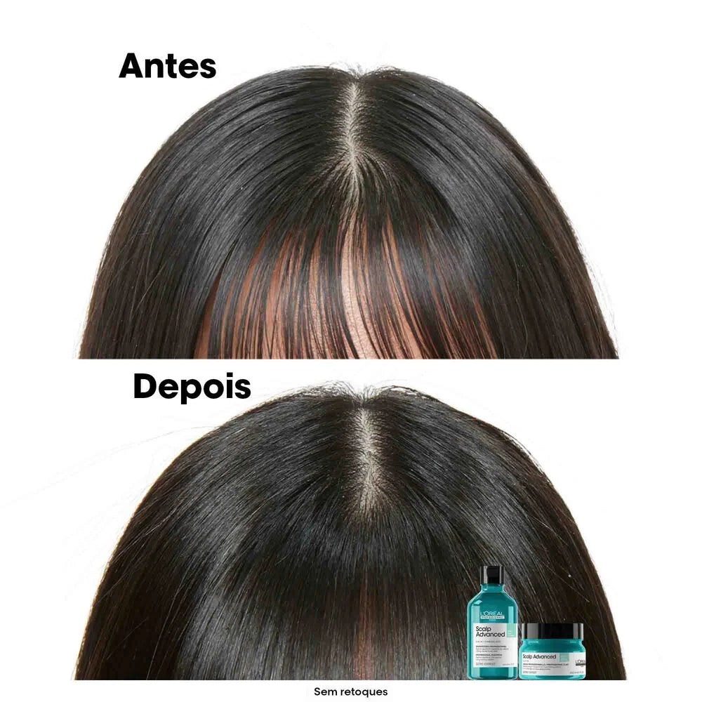 Shampoo Anti-Oleosidade | Scalp Advanced | 300ml | L'Oréal Professionnel