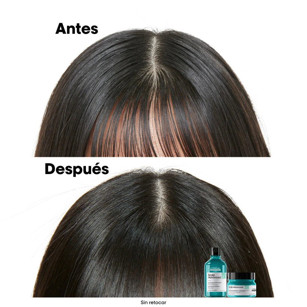 Shampoo Anti-Caspa | Scalp Advanced | 300ml | L'Oréal Professionnel